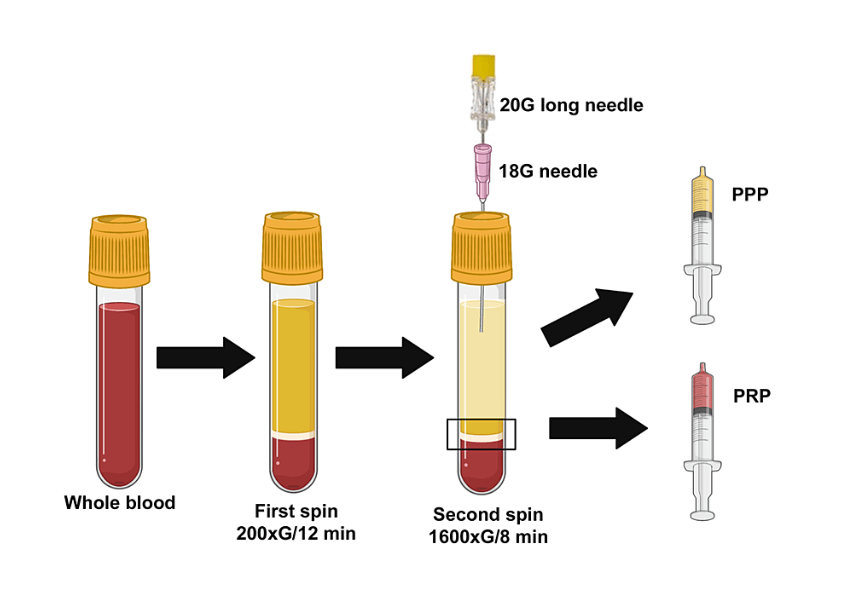  Doubling the centrifugation of the blood sample